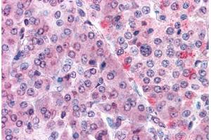 Human Pancreas: Formalin-Fixed, Paraffin-Embedded (FFPE)