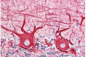 Human Brain, Cerebellum: Formalin-Fixed, Paraffin-Embedded (FFPE) (INA anticorps)