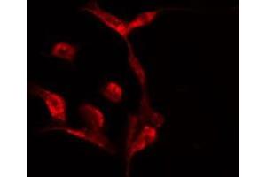 ABIN6275524 staining  HeLa cells by IF/ICC.