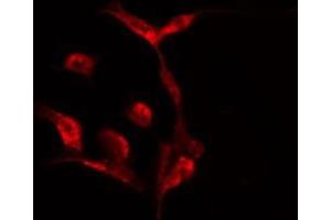 ABIN6275524 staining  HeLa cells by IF/ICC. (Septin 7 anticorps  (C-Term))
