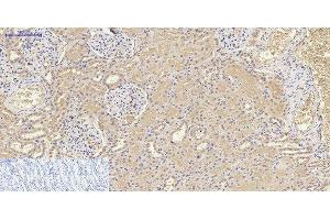 Immunohistochemistry of paraffin-embedded Human kidney tissue using IL8 Polyclonal Antibody at dilution of 1:200. (IL-8 anticorps)