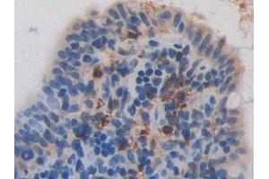 Detection of RNASE3 in Rat Intestine Tissue using Polyclonal Antibody to Ribonuclease A3 (RNASE3)