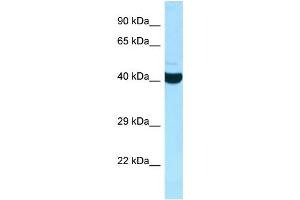 WB Suggested Anti-ADPRHL2 Antibody Titration: 1.