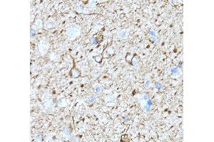 IHC analysis of Alpha Internexin/INA using anti-Alpha Internexin/INA antibody (ABIN7602187). (INA anticorps  (AA 62-169))