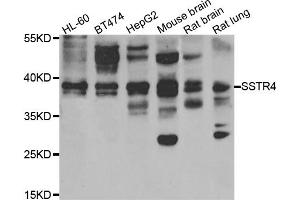 Western blot analysis of extracts of various cell lines, using SSTR4 antibody (ABIN5975458) at 1/1000 dilution. (SSTR4 anticorps)