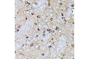 Immunohistochemistry of paraffin-embedded rat brain using Argonaute-2 antibody (ABIN7265671) at dilution of 1:100 (40x lens). (AGO2 anticorps)