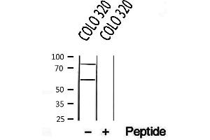 Western blot analysis of extracts from COLO 320, using CREB3L1,OASIS antibody. (CREB3L1 anticorps  (N-Term))