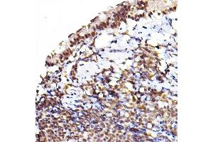 Immunohistochemistry of paraffin-embedded rat lung using Phospho--S473+-S474+-S472 Rabbit pAb (ABIN7265523) at dilution of 1:100 (40x lens). (AKT 1/2/3 anticorps  (pSer472))