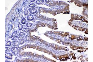 IHC analysis of UGT1A1 using anti-UGT1A1 antibody .