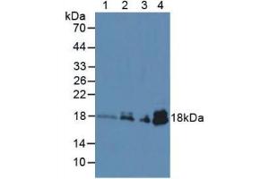 Figure. (TNNC1 anticorps  (AA 1-161))