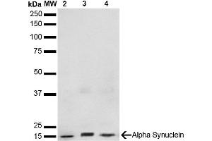 Western Blot analysis of Human, Mouse, Rat Brain showing detection of 14 kDa Alpha Synuclein protein using Mouse Anti-Alpha Synuclein Monoclonal Antibody, Clone 3F8 (ABIN5564101). (SNCA anticorps  (FITC))