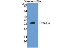 Western Blotting (WB) image for anti-Hemoglobin beta (HBB) (AA 1-147) antibody (ABIN2116576) (Hemoglobin Subunit beta anticorps  (AA 1-147))
