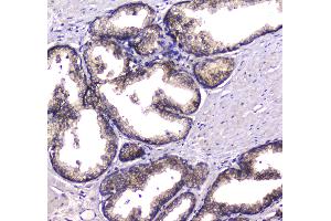 IHC analysis of HGD using anti-HGD antibody .