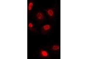Immunofluorescent analysis of TLE1 staining in U2OS cells. (TLE1 anticorps)