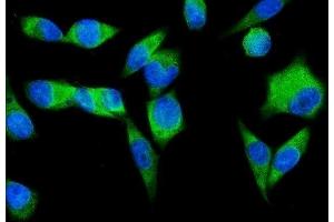 IF analysis of SND1 using anti-SND1 antibody (ABIN7600525). (SND1 anticorps  (AA 20-204))