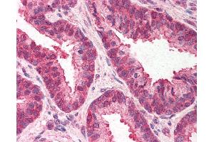 Anti-TMED10 / TMP21 antibody IHC of human prostate. (TMED10 anticorps  (C-Term))