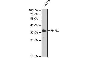 Western blot analysis of extracts of SW480 cells, using PHF11 antibody (ABIN6290738) at 1:1000 dilution. (PHF11 anticorps)