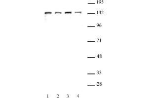 SMC3 antibody (pAb) tested by Western blot. (SMC3 anticorps  (C-Term))