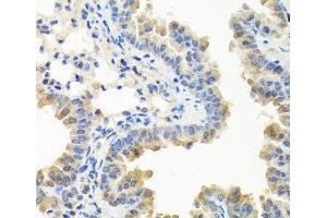 Immunohistochemistry of paraffin-embedded Mouse lung using LRG1 Polyclonal Antibody at dilution of 1:100 (40x lens). (LRG1 anticorps)