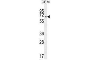 COX10 Antibody (C-term) western blot analysis in CEM cell line lysates (35µg/lane). (COX10 anticorps  (C-Term))