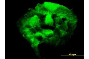 Immunofluorescence of monoclonal antibody to PAPSS2 on A-431 cell.