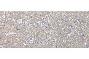 Immunohistochemistry of paraffin-embedded Human brain tissue using ETFB Polyclonal Antibody at dilution of 1:40(x200)
