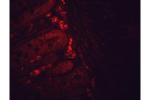 Immunohistochemistry analysis using Mouse Anti-Hsp90 Monoclonal Antibody, Clone H9010 (ABIN361717 and ABIN361718).