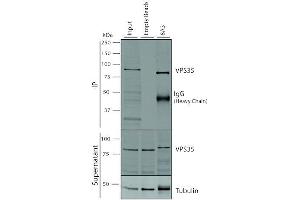 Immunoprecipitation analysis using Mouse Anti-VPS35 Monoclonal Antibody, Clone 8A3 (ABIN6932977). (VPS35 anticorps  (PerCP))