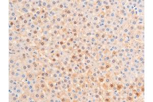 ABIN6267224 at 1/100 staining rat liver tissue sections by IHC-P. (CHEK1 anticorps  (pSer317))