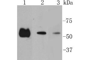 Lane 1: Hela lysates, Lane 2:A431 lysates, Lane 3: PC12 lysates probed with Smad2 (9A3) Monoclonal Antibody  at 1:1000 overnight at 4˚C. (SMAD2 anticorps)