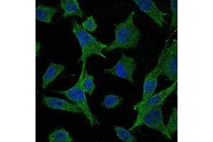 Immunofluorescence analysis of Hela cells using MAP2K6 mouse mAb (green).