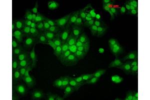Immunocytochemistry/Immunofluorescence analysis using Mouse Anti-CaMKII Monoclonal Antibody, Clone 6G9 . (CAMKII gamma anticorps  (FITC))