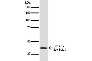 Western Blot analysis of Mouse Brain showing detection of ~40 kDa Nav Beta 3 protein using Mouse Anti-Nav Beta 3 Monoclonal Antibody, Clone S396-29 . (SCN3B anticorps  (AA 1-215) (PE))