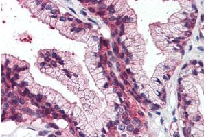 Anti-SLC39A14 antibody  ABIN960809 IHC staining of human prostate. (SLC39A14 anticorps  (Cytoplasmic Domain))