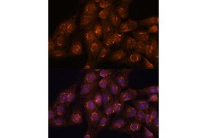 Immunofluorescence analysis of C6 cells using  antibody (ABIN7265416) at dilution of 1:100.