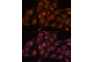 Immunofluorescence analysis of C6 cells using  antibody (ABIN7265416) at dilution of 1:100. (ACBD3 anticorps  (AA 1-160))