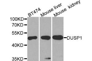 Western blot analysis of extracts of various cell lines, using DUSP1 antibody. (DUSP1 anticorps)