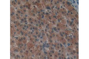 Used in DAB staining on fromalin fixed paraffin- embedded liver tissue