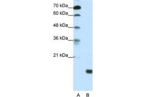 Western Blotting (WB) image for anti-TGFB-Induced Factor Homeobox 2-Like, Y-Linked (TGIF2LY) antibody (ABIN2461298) (TGIF2LY anticorps)