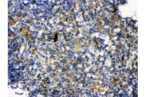 Anti- TLR7 Picoband antibody, IHC(P) IHC(P): Mouse Thymus Tissue