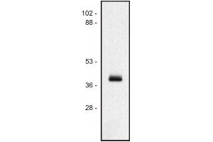 Western blot of human Ramos B cell line (MICA anticorps  (PE))