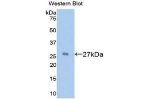 Detection of Recombinant a1BG, Mouse using Polyclonal Antibody to Alpha-1-B-Glycoprotein (a1BG) (A1BG anticorps  (AA 313-512))
