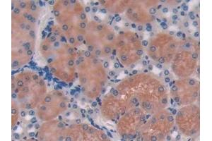 Detection of CD74 in Mouse Kidney Tissue using Polyclonal Antibody to Cluster Of Differentiation 74 (CD74)