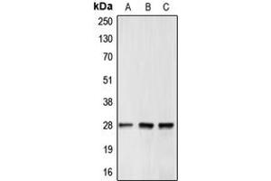 Western blot analysis of BCL2 expression in MCF7 (A), mouse brain (B), rat kidney (C) whole cell lysates. (Bcl-2 anticorps  (Center))