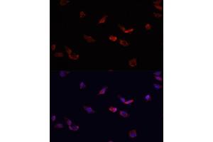 Immunofluorescence analysis of HeLa cells using BMPR2 antibody  at dilution of 1:100.