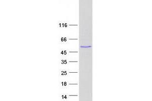 Validation with Western Blot