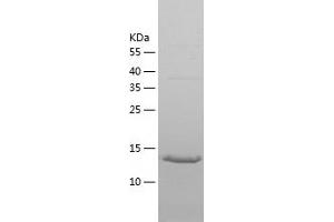 Western Blotting (WB) image for Regulator of G-Protein Signaling 21 (RGS21) (AA 1-152) protein (His tag) (ABIN7124817) (RGS21 Protein (AA 1-152) (His tag))