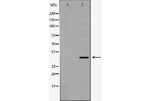Western blot analysis of Hela cell lysate, using SULT2A1 Antibody. (SULT2A1 anticorps  (C-Term))