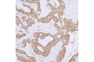Immunohistochemistry (IHC) image for anti-Dihydrolipoamide Dehydrogenase (DLD) (AA 459-509) antibody (ABIN7453411) (DLD anticorps  (AA 459-509))