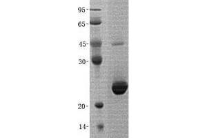 Validation with Western Blot (GGCT Protein (His tag))